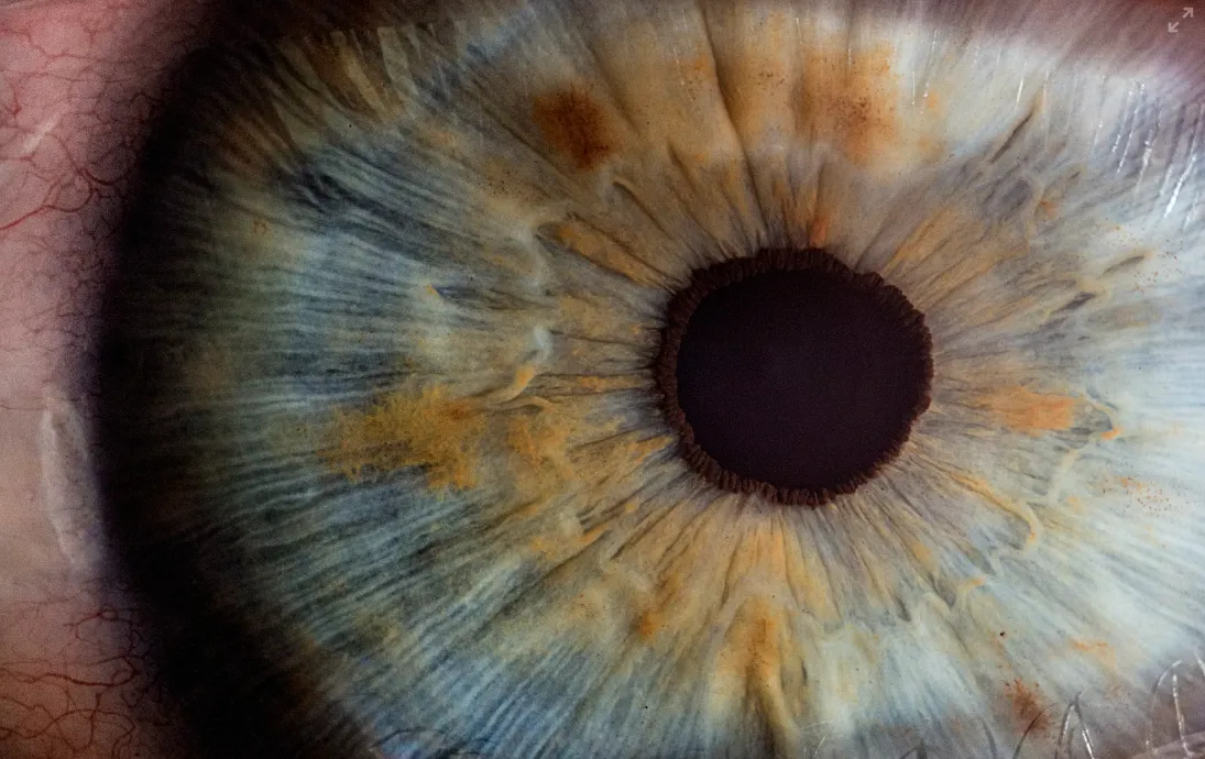 TANOMETRIA AGUALDULCE